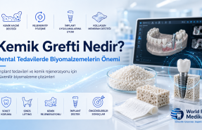 kemik grefti nedir